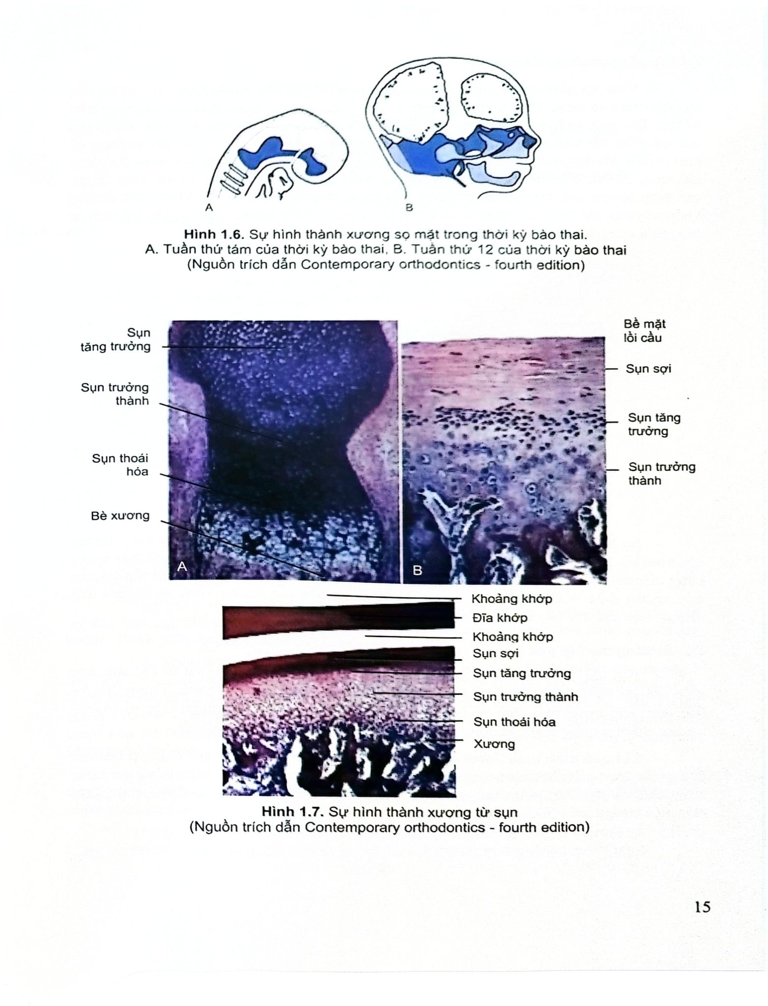 Chỉnh Hình Răng Mặt Cơ Bản - TS. Võ Thị Thúy Hồng