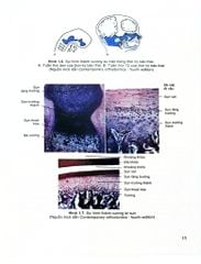 Chỉnh Hình Răng Mặt Cơ Bản - TS. Võ Thị Thúy Hồng