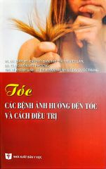 Tóc Các Bệnh Ảnh Hưởng Đến Tóc Và Cách Điều Trị