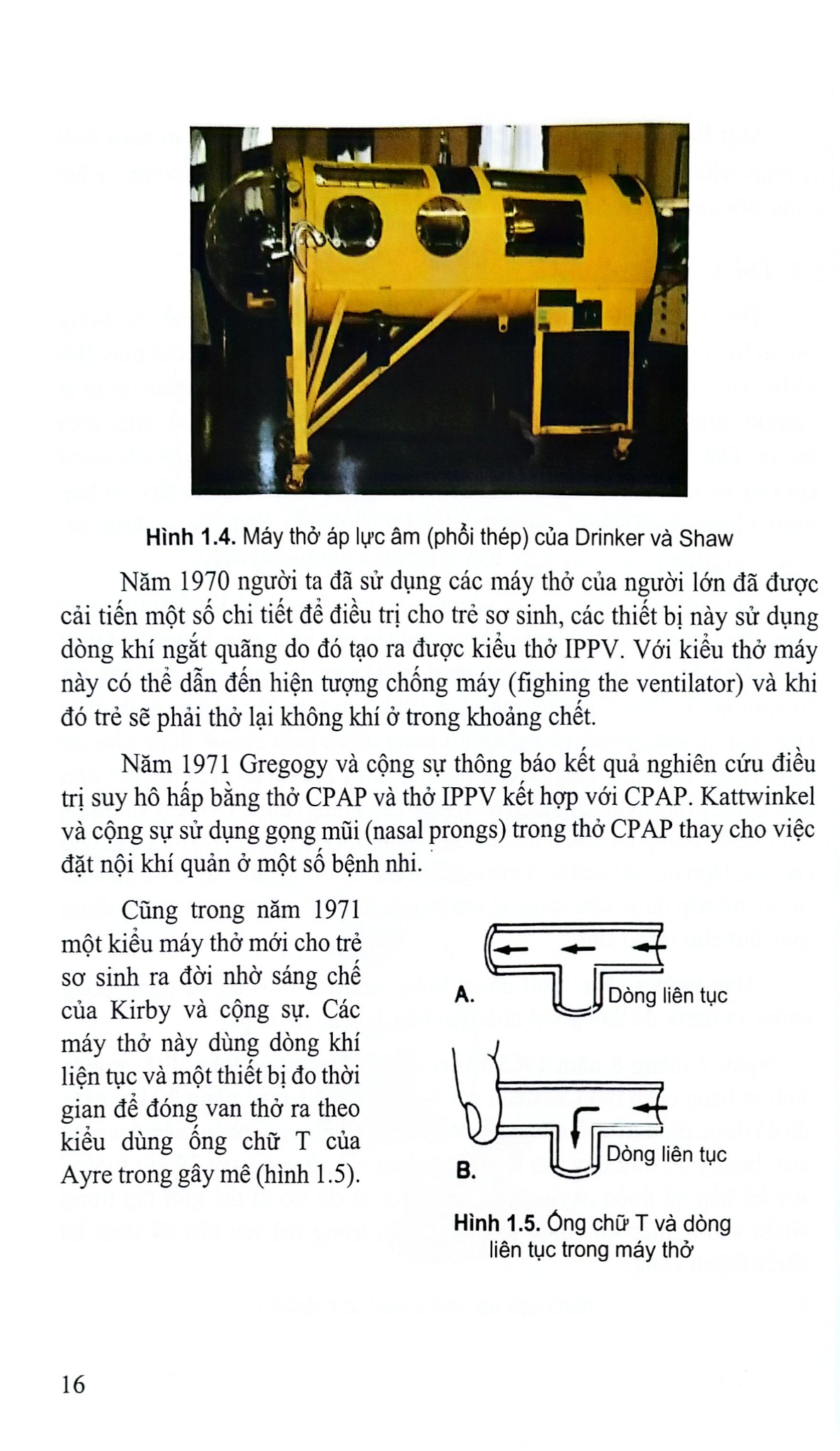 Thông Khí Nhân Tạo Cho Trẻ Em Và Sơ Sinh - PGS.TS.BS.Nguyễn Tiến Dũng