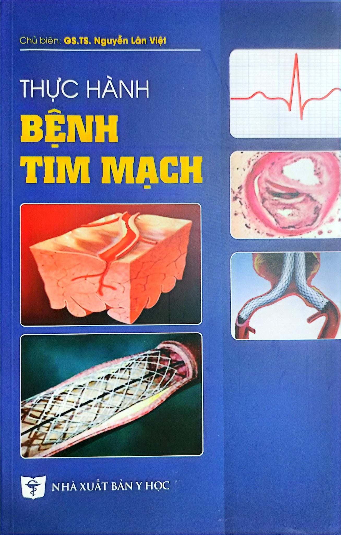 Thực Hành Bệnh Tim Mạch - GS.TS. Nguyễn Lân Việt