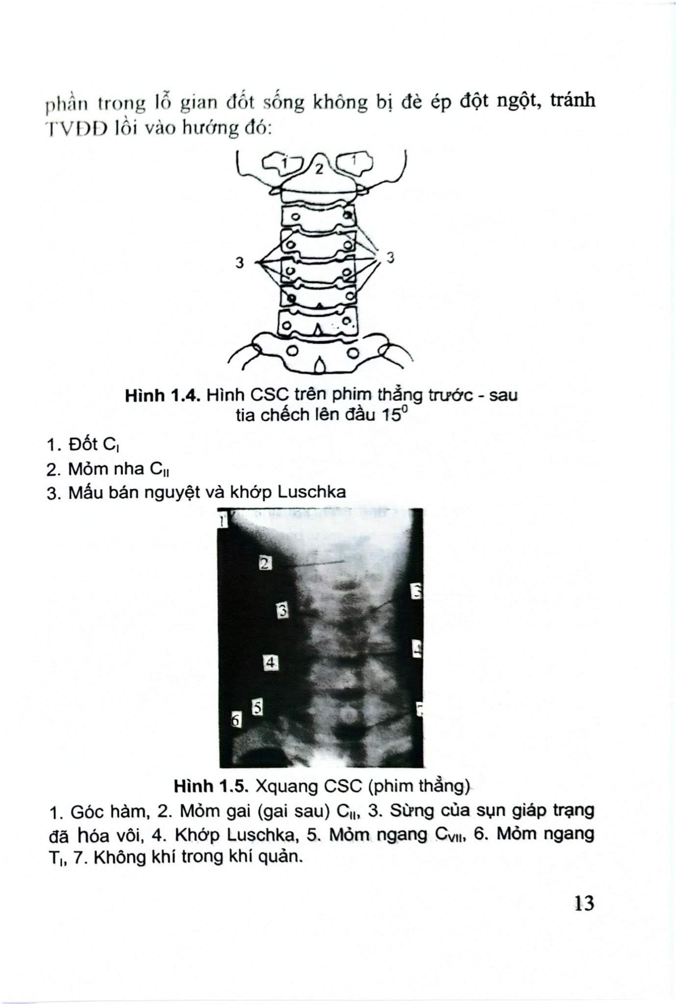 Thoái Hóa Cột Sống Cổ Và Thoát Vị Đĩa Đệm - GS.TS.GVCC. Hồ Hữu Lương