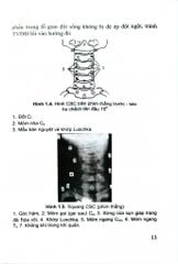Thoái Hóa Cột Sống Cổ Và Thoát Vị Đĩa Đệm - GS.TS.GVCC. Hồ Hữu Lương