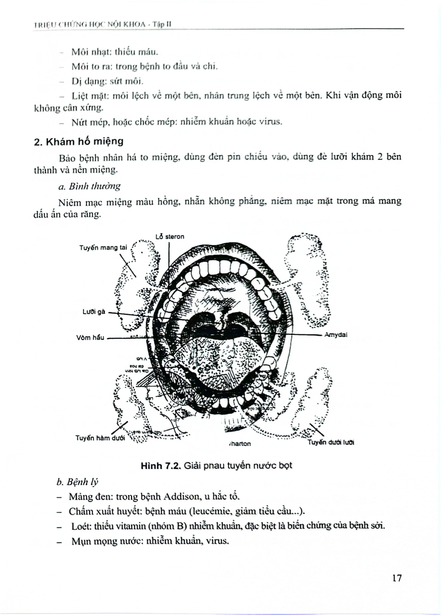 Triệu Chứng Học Nội Khoa Tập 2 (2023) - ĐH Y Hà Nội- Các Bộ môn Nội