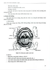 Triệu Chứng Học Nội Khoa Tập 2 (2023) - ĐH Y Hà Nội- Các Bộ môn Nội