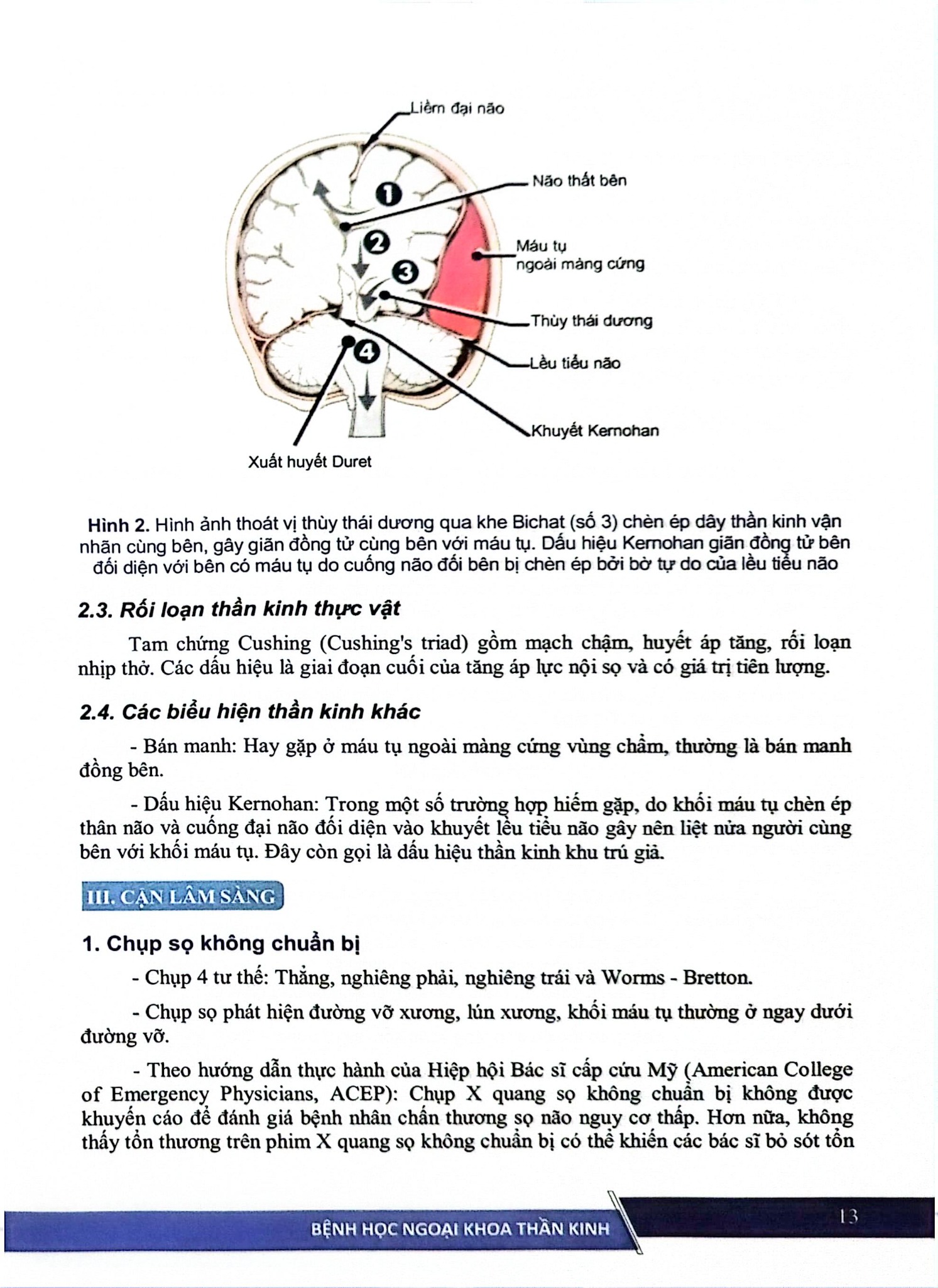 Bệnh Học Ngoại Khoa Thần Kinh (Dùng Cho Đào Tạo Sau Đại Học) - ĐH Y Hà Nội