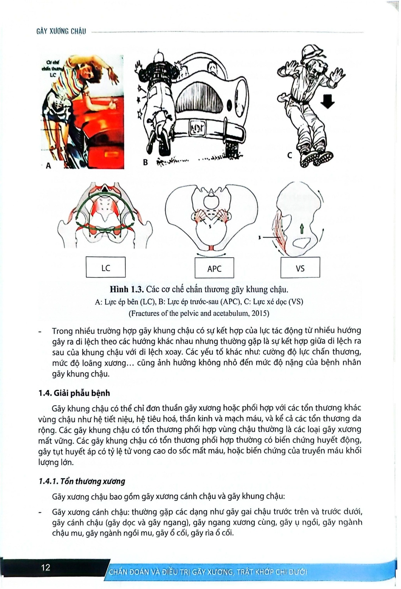 Chẩn Đoán Và Điều Trị Gãy Xương Trật Khớp Chi Dưới (SĐH) - ĐH Y Hà Nội, GS.TS Trần Trung Dũng