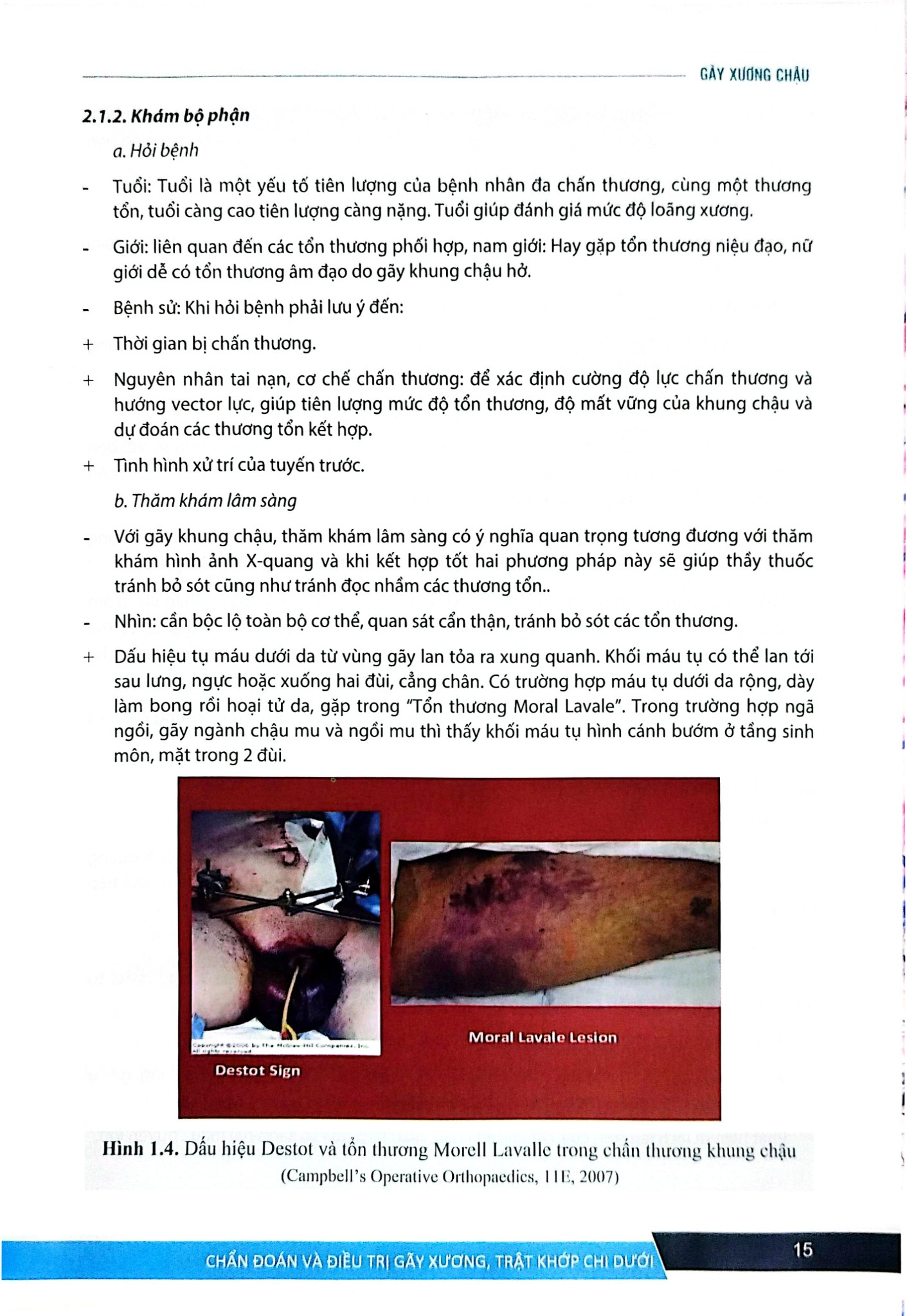 Chẩn Đoán Và Điều Trị Gãy Xương Trật Khớp Chi Dưới (SĐH) - ĐH Y Hà Nội, GS.TS Trần Trung Dũng