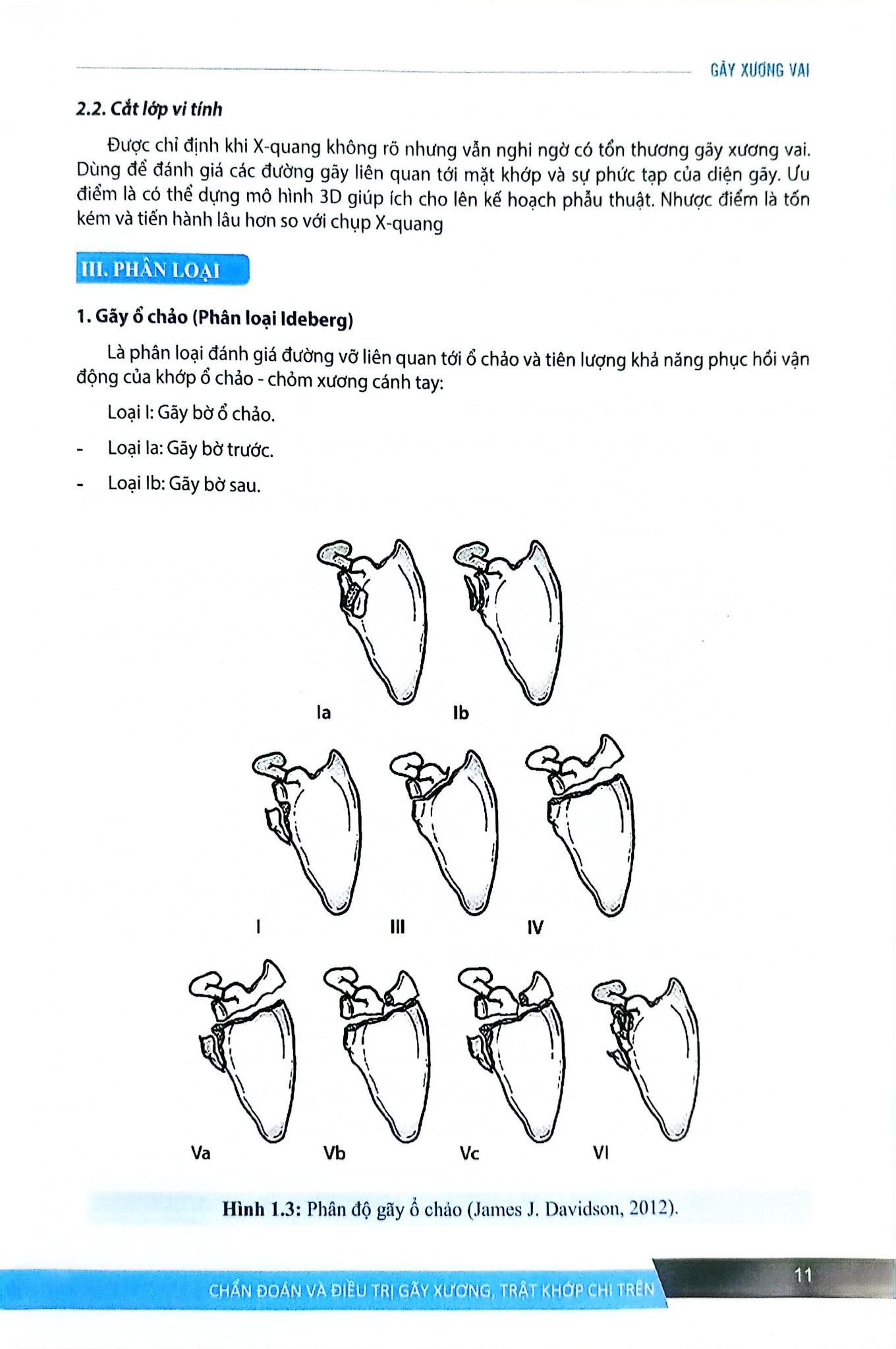 Chẩn Đoán Và Điều Trị Gãy Xương Trật Khớp Chi Trên (Giáo Trình Đào Tạo Sau Đại Học) - ĐH Y Hà Nội, GS.TS Trần Trung Dũng