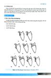  Chẩn Đoán Và Điều Trị Gãy Xương Trật Khớp Chi Trên (Giáo Trình Đào Tạo Sau Đại Học) - ĐH Y Hà Nội, GS.TS Trần Trung Dũng 