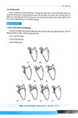 Chẩn Đoán Và Điều Trị Gãy Xương Trật Khớp Chi Trên (Giáo Trình Đào Tạo Sau Đại Học) - ĐH Y Hà Nội, GS.TS Trần Trung Dũng