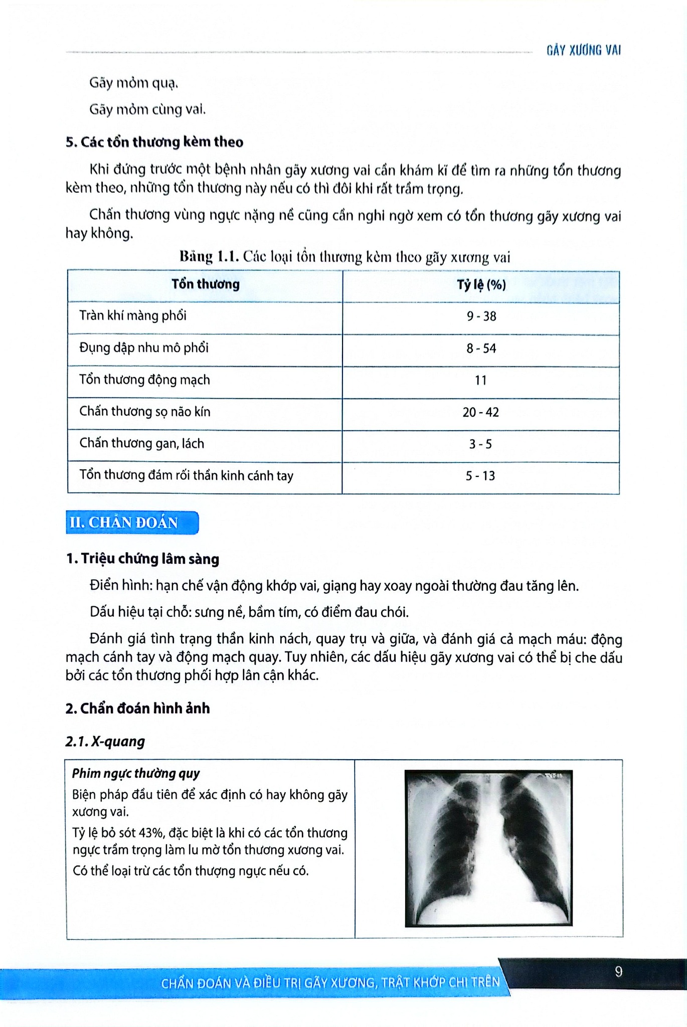 Chẩn Đoán Và Điều Trị Gãy Xương Trật Khớp Chi Trên (Giáo Trình Đào Tạo Sau Đại Học) - ĐH Y Hà Nội, GS.TS Trần Trung Dũng
