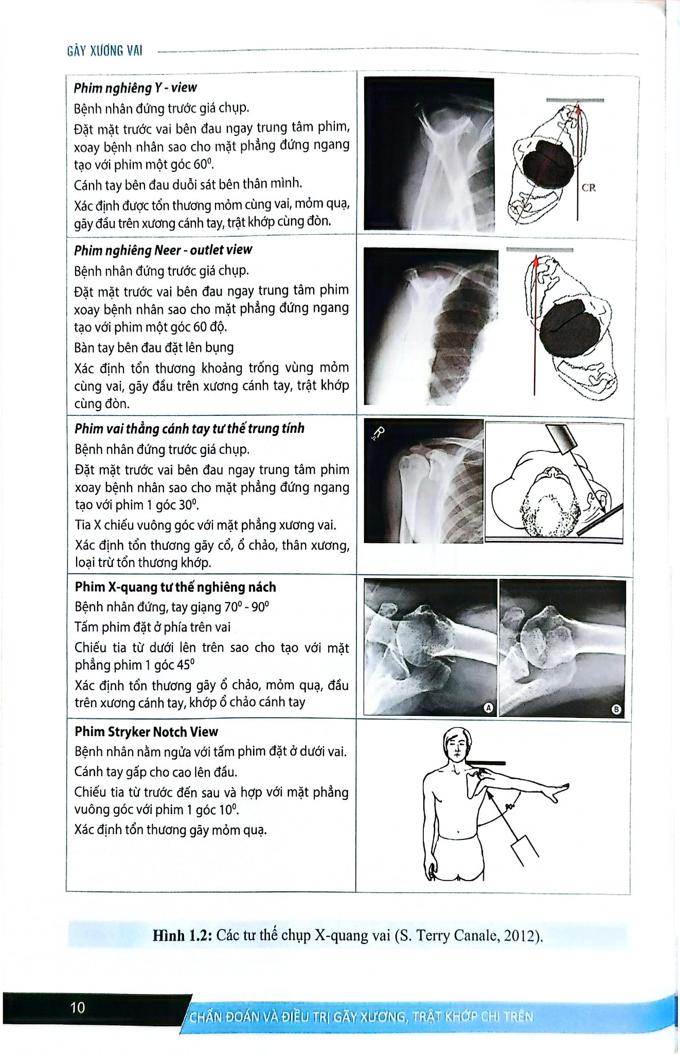 Chẩn Đoán Và Điều Trị Gãy Xương Trật Khớp Chi Trên (Giáo Trình Đào Tạo Sau Đại Học) - ĐH Y Hà Nội, GS.TS Trần Trung Dũng