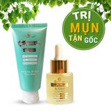  Bộ Tri Mụn ẩn, Mụn trứng cá, Giảm mờ thâm Doctor Care dịu nhẹ dành cho nam nữ da dầu mụn (Serum 20ml + sữa rửa mặt 130g) 