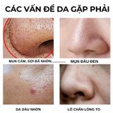  Mặt nạ đất sét giảm mụn trắng mịn tự nhiên YELLOW CLAY Copaiba Doctor care Oroxylum  Face Mask 50g 