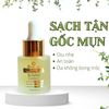 Serum Trị Mụn ẩn, mụn đầu đen cho da dầu tuổi dậy thì Doctor care