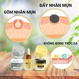  Bộ Tri Mụn ẩn ,Mụn đầu đen,Mụn thâm Doctor Care  (serum+ kem+ mặt nạ) 