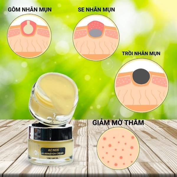  Kem Đặc Tri Mụn ẩn, Mụn đầu đen Doctor Care Acnes Elimination Cream 30g 