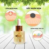  Serum Trị  Mụn Ẩn, Mụn Đầu Đen , Mụn Thâm  Doctor Care 20ml 