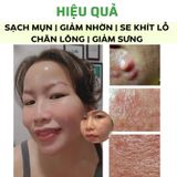  Serum Doctor care Giải pháp hoàn hảo cho làn da sạch mụn tận gốc 