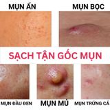  Serum Doctor care Giải pháp hoàn hảo cho làn da sạch mụn tận gốc 