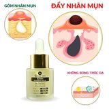  Serum Trị  Mụn Ẩn, Mụn Đầu Đen , Mụn Thâm  Doctor Care 20ml 