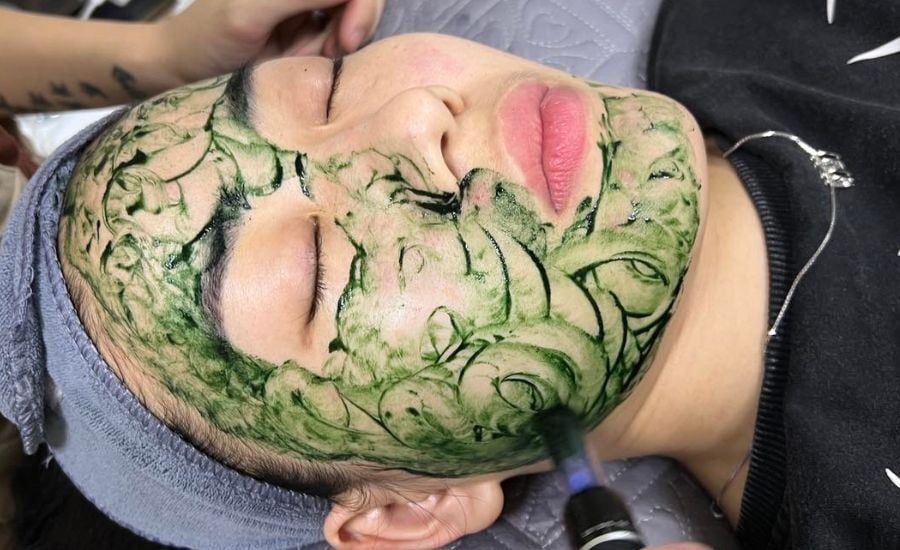  Cấy tảo xoắn Nano 