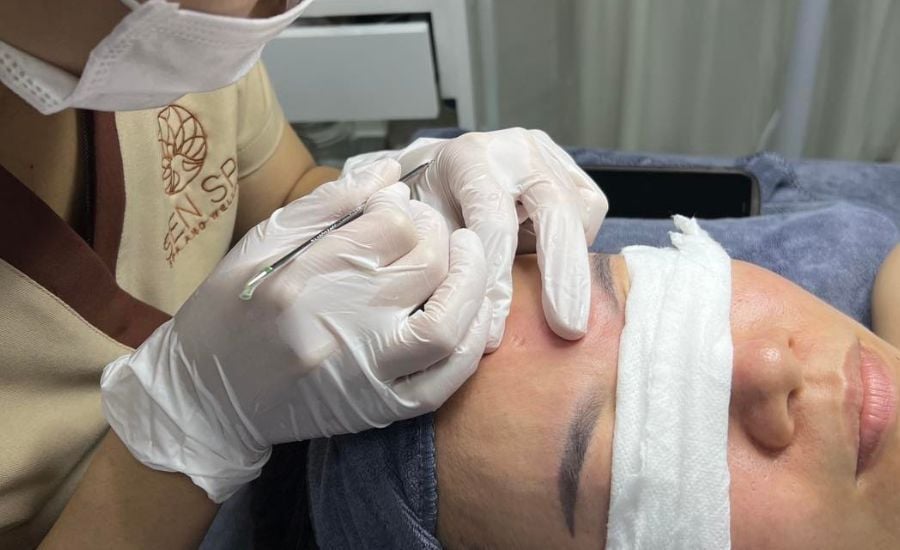  Cấy tảo xoắn Nano 