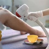  Triệt lông 1/2 chân 