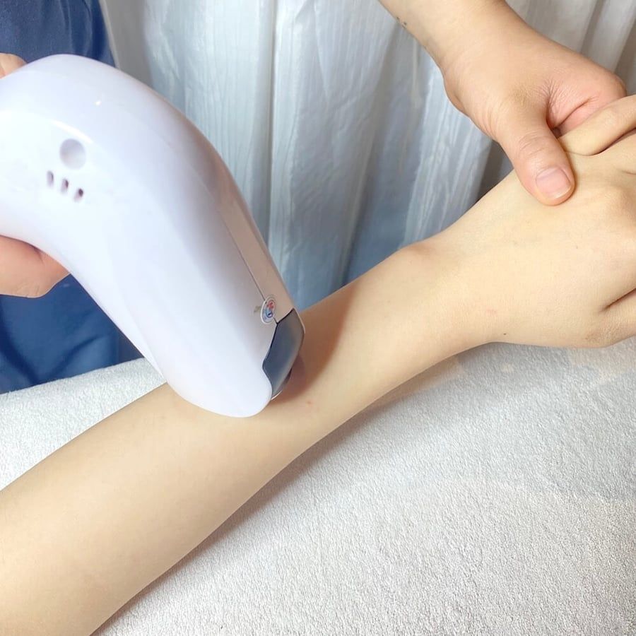  Triệt lông toàn thân 