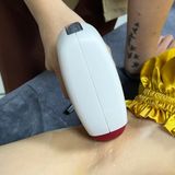  Triệt lông nách vĩnh viễn 