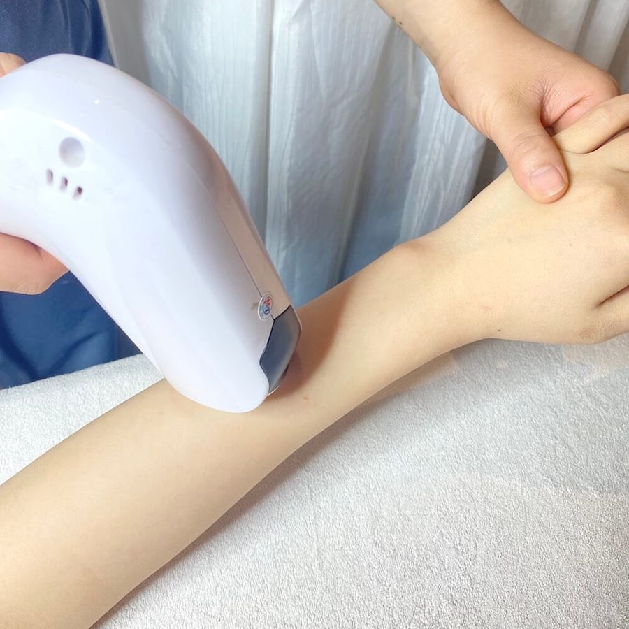  Triệt lông tay vĩnh viễn 