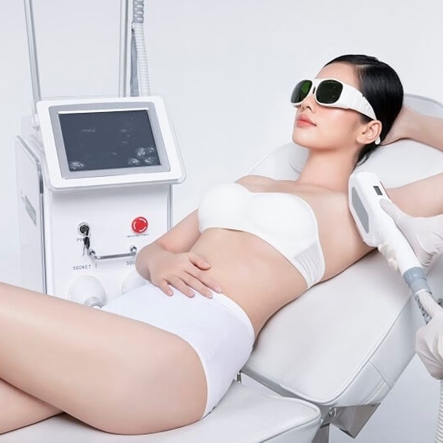  Triệt lông toàn thân 