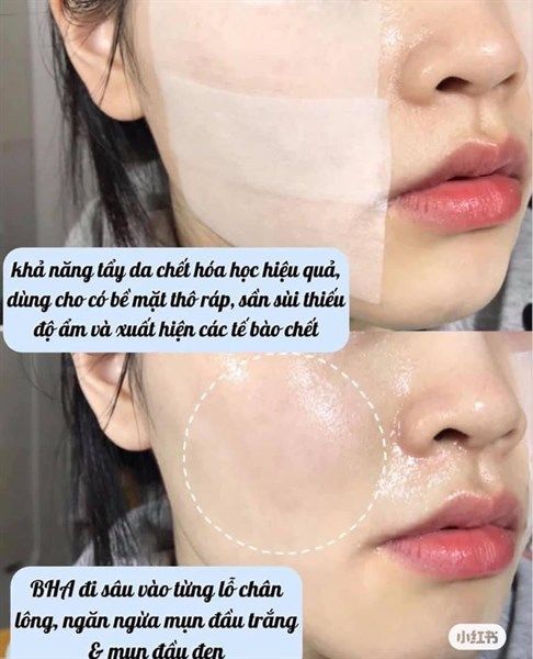 NƯỚC HOA HỒNG NGỪA MỤN COSRX AHA/BHA CLARIFYING TREATMENT TONER 280ML