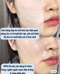 NƯỚC HOA HỒNG NGỪA MỤN COSRX AHA/BHA CLARIFYING TREATMENT TONER 280ML