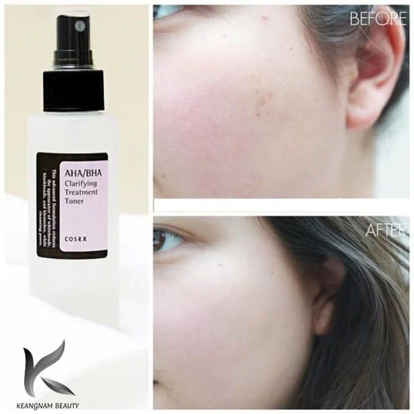 NƯỚC HOA HỒNG NGỪA MỤN COSRX AHA/BHA CLARIFYING TREATMENT TONER 280ML
