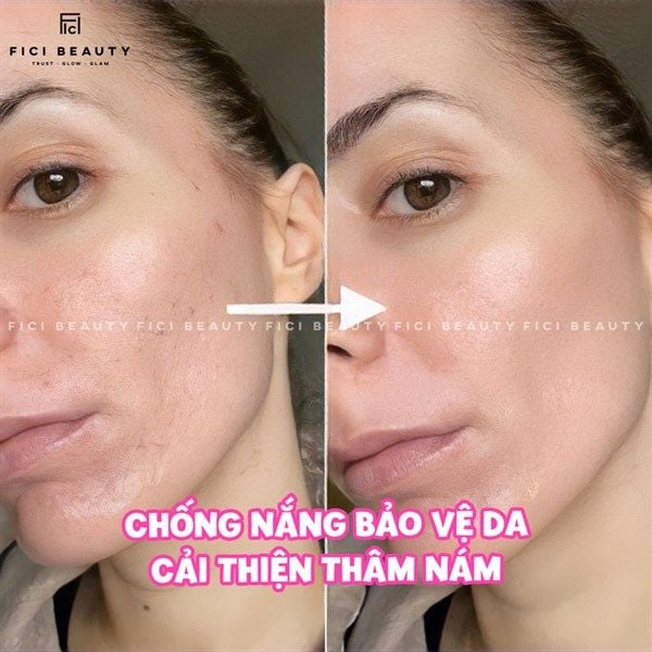 Viên Uống Trắng Da, Hỗ Trợ Chống Nắng Triple White - 50 viên