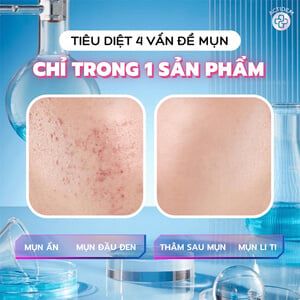 Gel Giảm Mụn Thâm Actidem Derma Gel 18g