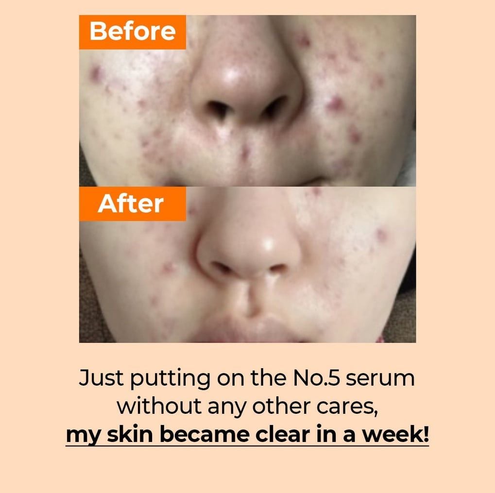 Tinh chất chống lão hoá, trắng sáng đều màu da Numbuzin No.5+ Vitamin Concentrated Serum 30ml