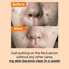 Tinh chất chống lão hoá, trắng sáng đều màu da Numbuzin No.5+ Vitamin Concentrated Serum 30ml