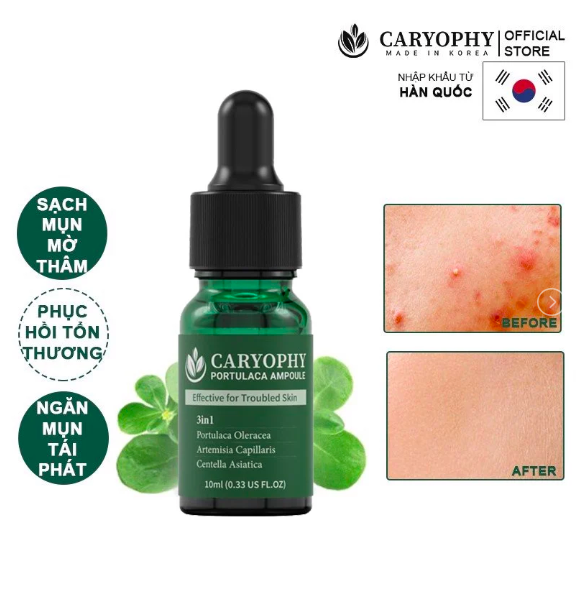 Tinh Chất Chăm Sóc Cho Da Mụn Caryophy Portulaca Ampoule