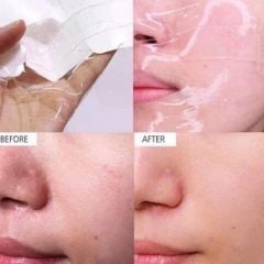 Mặt Nạ Thạch Celderma Marine Collagen Hydrogell Dưỡng Ẩm, Căng Bóng Da 30g ( Xanh )