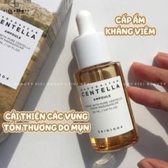 Tinh Chất Rau Má Skin1004 Centella – Giảm Mụn, Phục Hồi Da