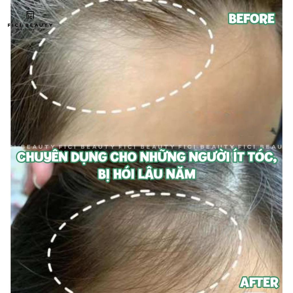 Tinh Chất Thảo Dược Kích Thích Mọc Tóc Sato Acrovis Solution 30mL