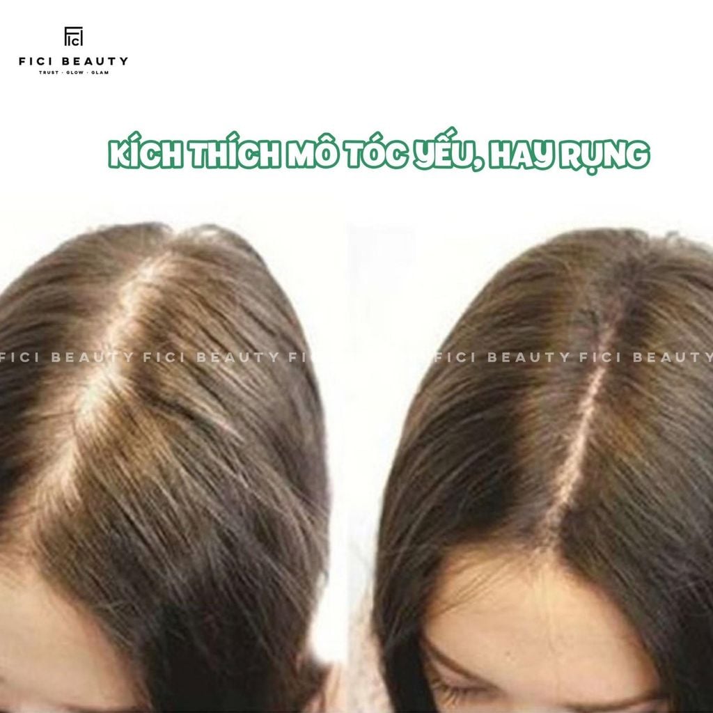 Tinh Chất Thảo Dược Kích Thích Mọc Tóc Sato Acrovis Solution 30mL