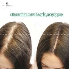 Tinh Chất Thảo Dược Kích Thích Mọc Tóc Sato Acrovis Solution 30mL