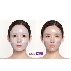 Mặt Nạ Dạng Thạch MediAnswer Mask 35g