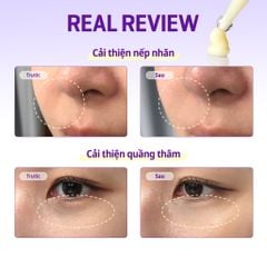 Kem dưỡng mắt Some By Mi Retinol Intense Advanced Triple Action Eye Cream 30ml