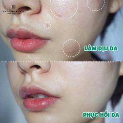 Tinh Chất Làm Dịu, Phục Hồi Da Timeless Vitamin B5 Hydration Serum 30ml