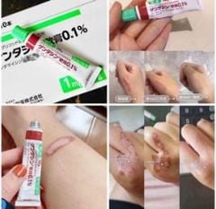 Kem GENTACIN Trị Sẹo Nhật 10g